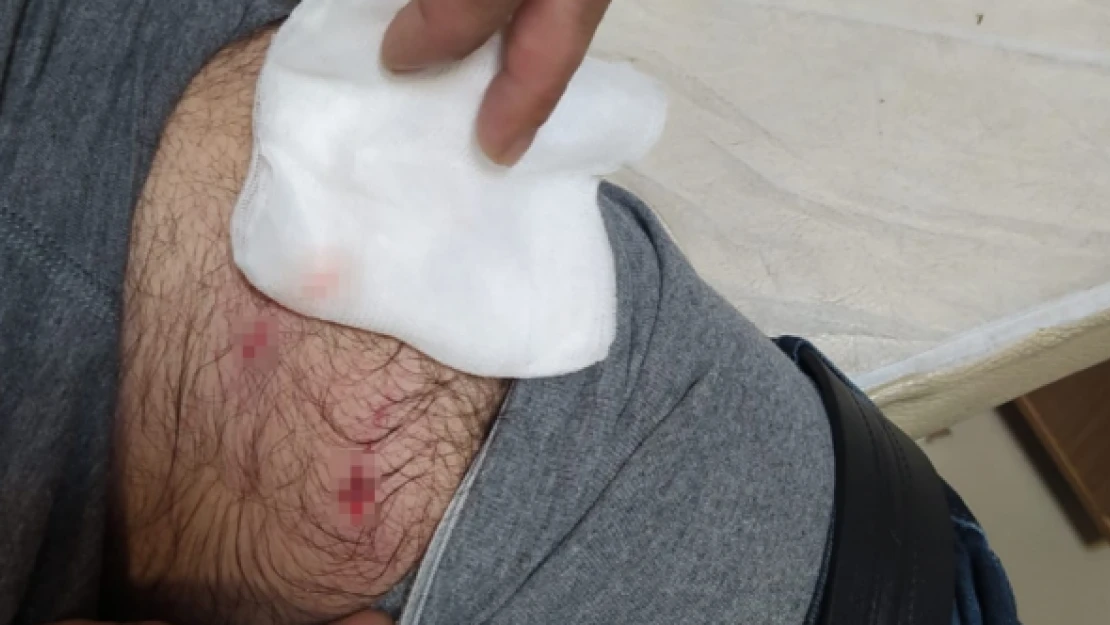 Bingöl'de köpek sürüsü vatandaşa böyle saldırdı!