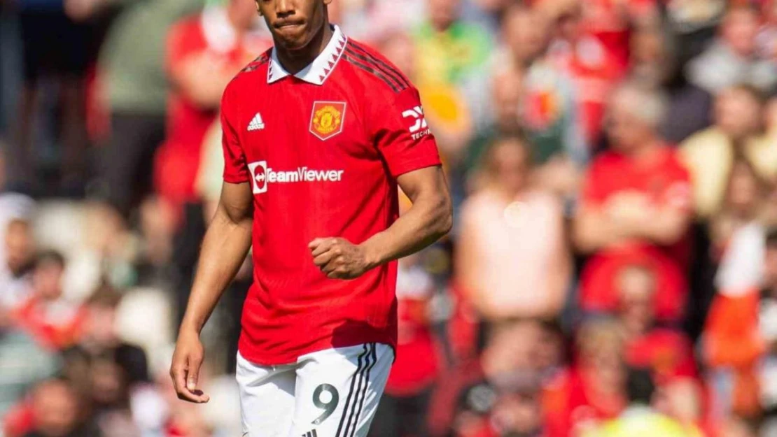 Manchester United'da Anthony Martial, yaklaşık 10 hafta sahalardan uzak kalacak