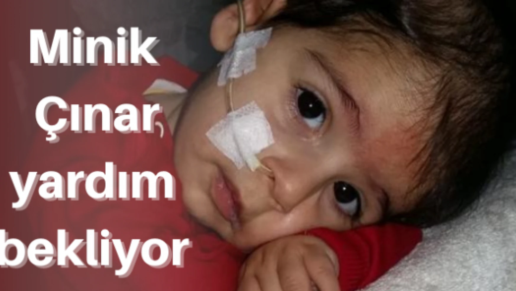 SMA hastası minik Çınar'a yardım çağrısı
