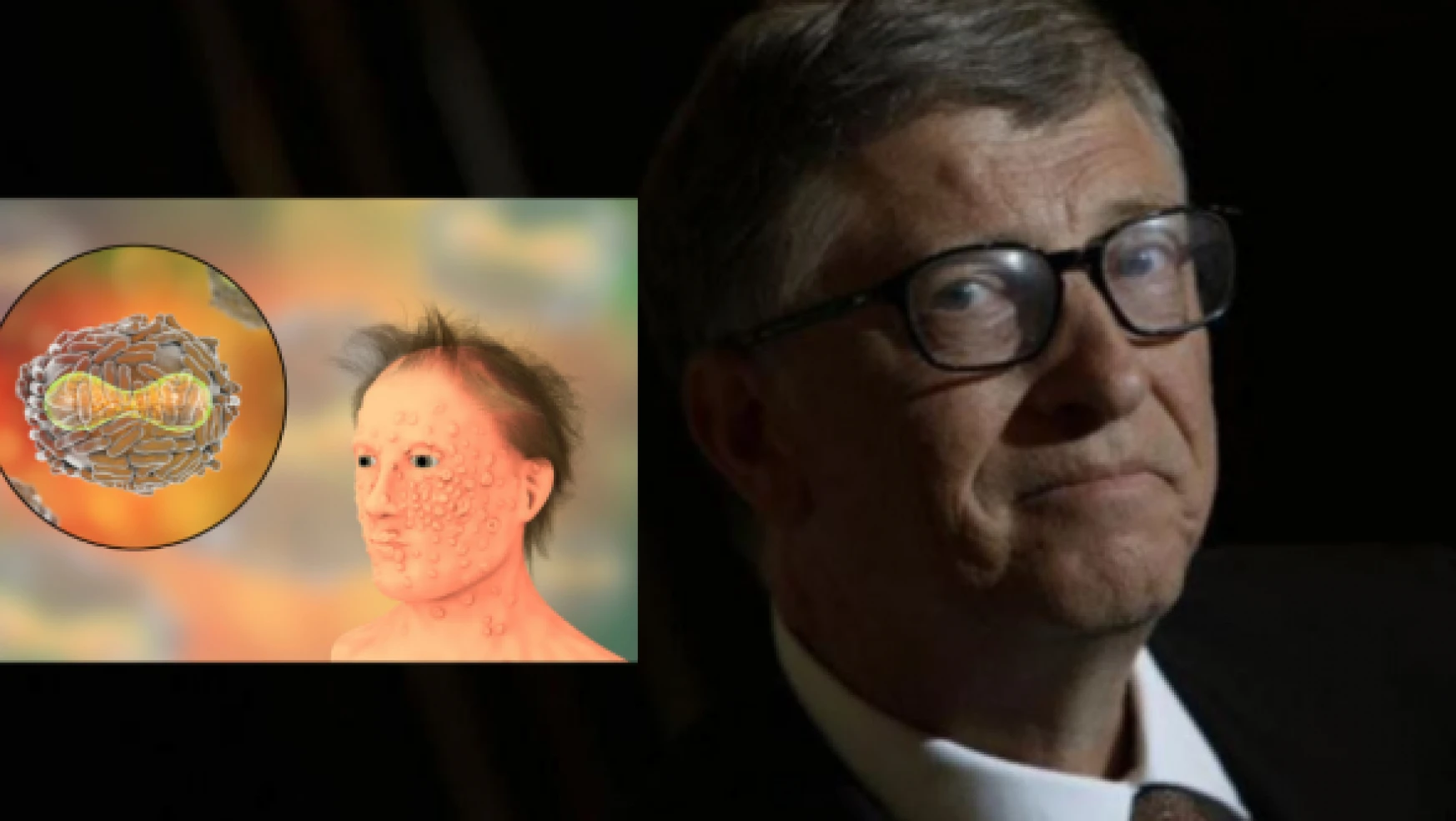 Bill Gates yeni salgının ismini 2 ay önce paylaşmış!