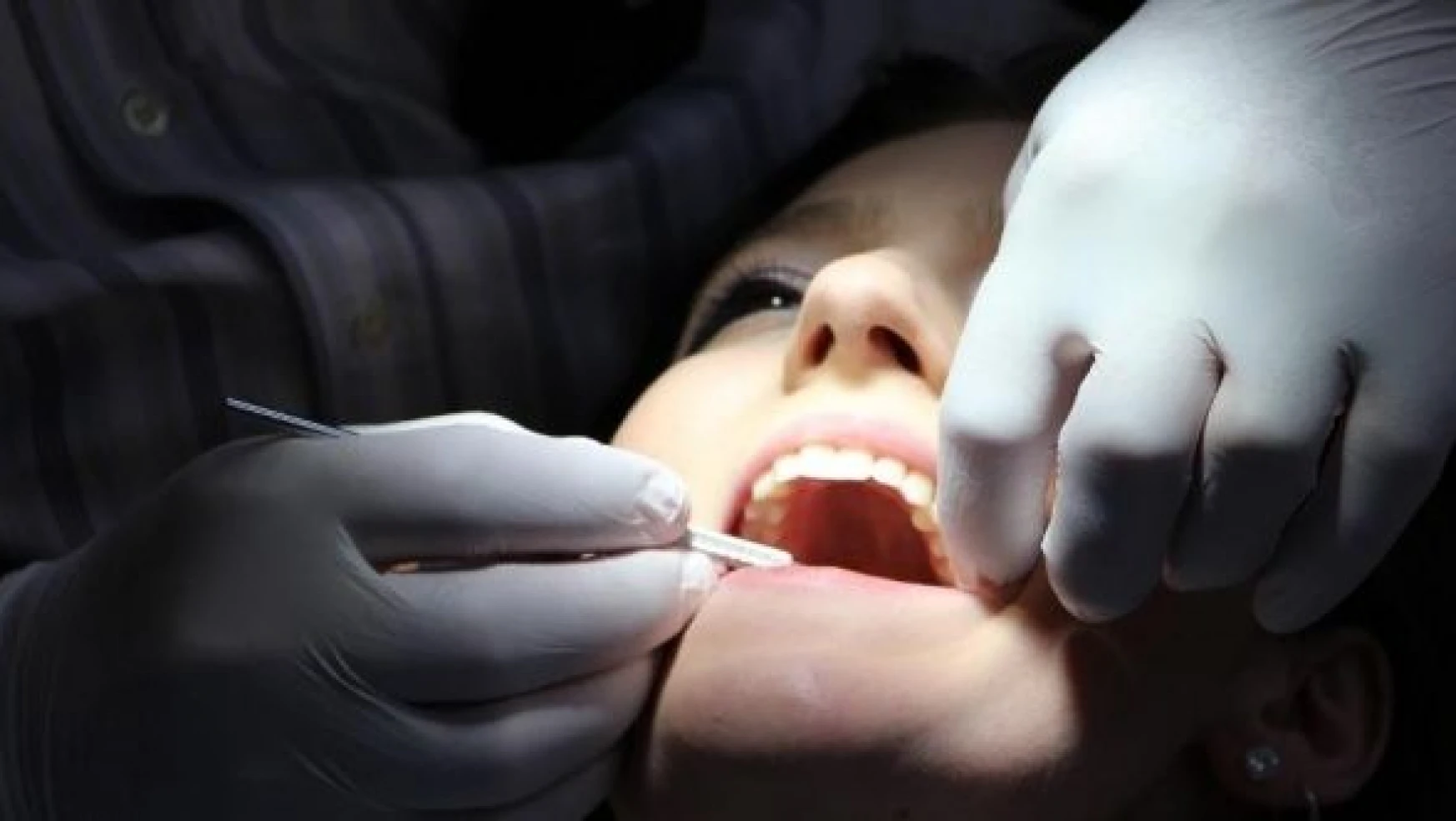 Malatya'da diş hastanesinin mesai saatleri uzatıldı