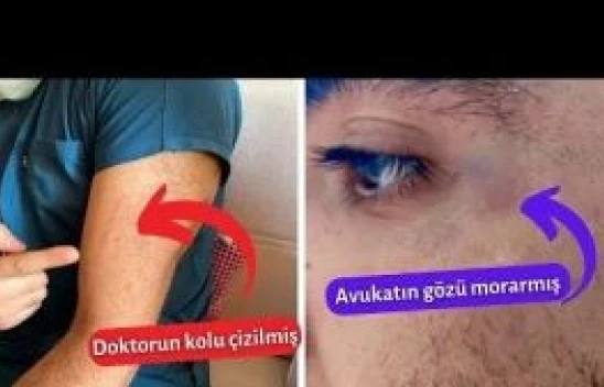 Van'da bir garip olay: doktor mu avukata saldırdı, avukat mı doktora saldırdı?