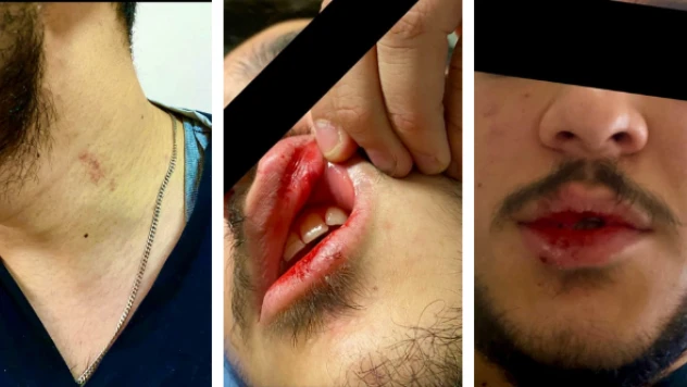 Kars İl Sağlık Müdürlüğü şiddet gören hemşireye sahip çıktı