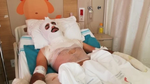 Isınmak için tiner döktü ölümden döndü