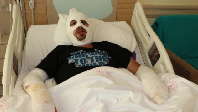 Kafe yangınında ağır yaralandı o anları böyle anlattı