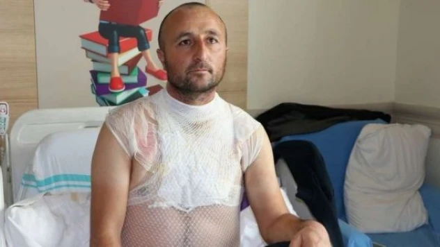 Dalgınlığı yüzünden yandı!