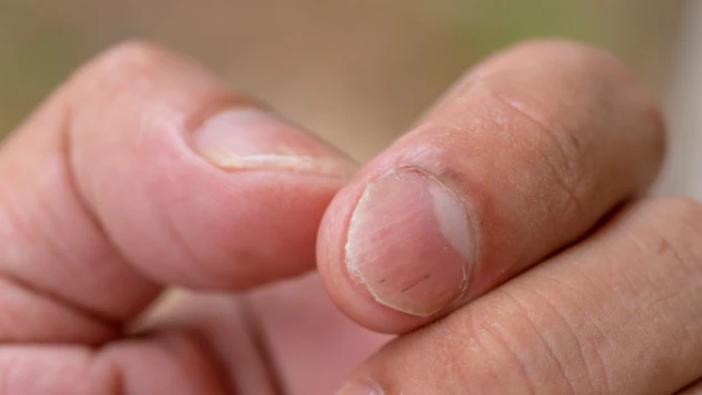 Gri, mavi ya da sarıysa hemen test olun!