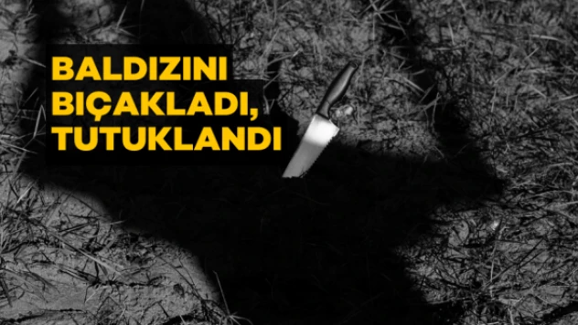 Kavga arasına giren baldız bıçak darbesinden kaçamadı