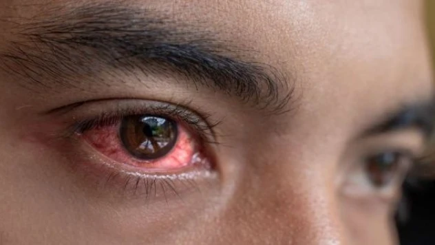 Kar körlüğüne dikkat!