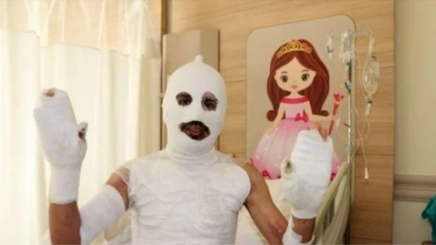 Tiner parladı tüm vücudu alev aldı!