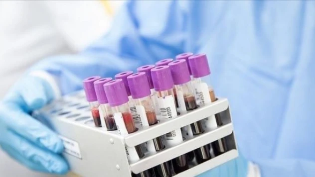 Uzmanlar cevapladı: Maymun çiçeğinin yayılımını nasıl önlenir?