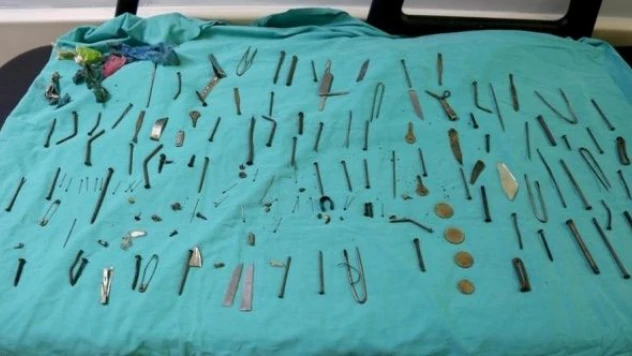 Midesinden çıkanlar şoke etti: 158 adet çakı, kesici alet, iğne...