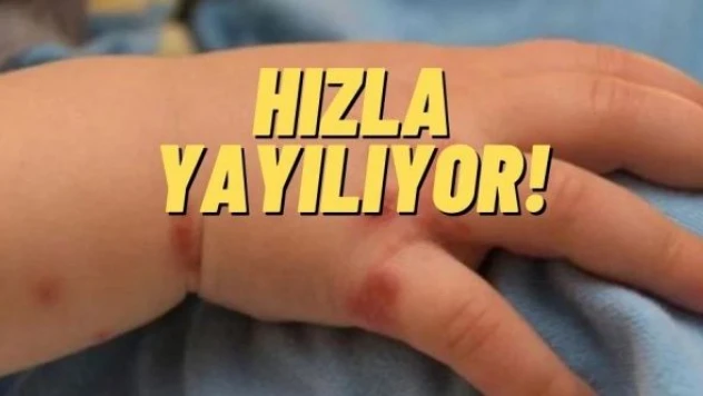 Domates gribi nedir, nasıl bulaşır? Domates gribinin belirtileri neler?