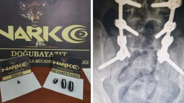 Uyuşturucuyu öyle bir yere sakladı ki...