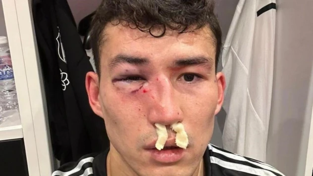 Beşiktaş: 'Zaynutdinov'un burnunda ve göz çukurunda kırık saptanmıştır'