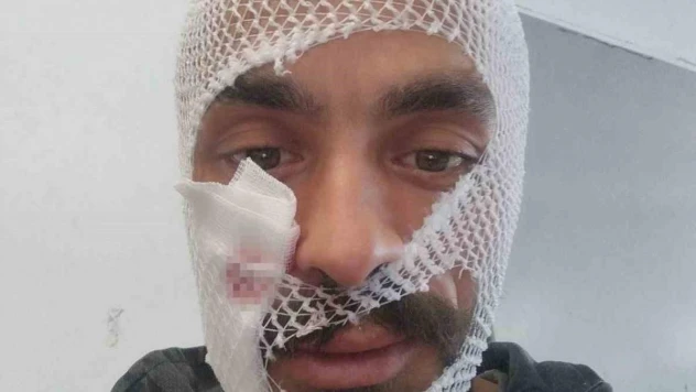 İneğinin boynuz darbeleri ile yaralanan gencin paylaşımı gülümsetti