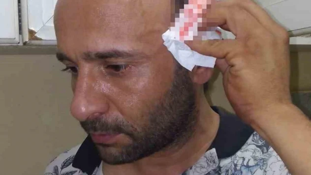 Kartal'da ev sahibinin oğlu, kira zammını kabul etmeyen kiracısını darp etti