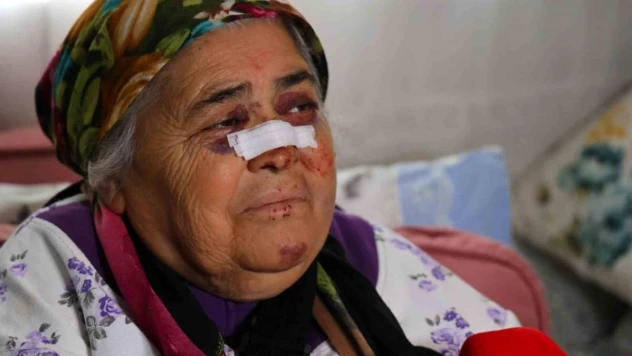 Otomobilin çarptığı yaşlı kadın: 'Gözümün içine bakıp kaçtı'