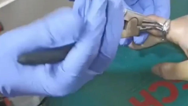 Parmağına sıkışan yüzüğü itfaiye çıkardı