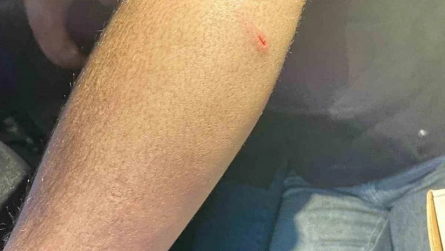 Siirt'te oto sanayisinde sokak köpeklerinin saldırdığı genç yaralandı