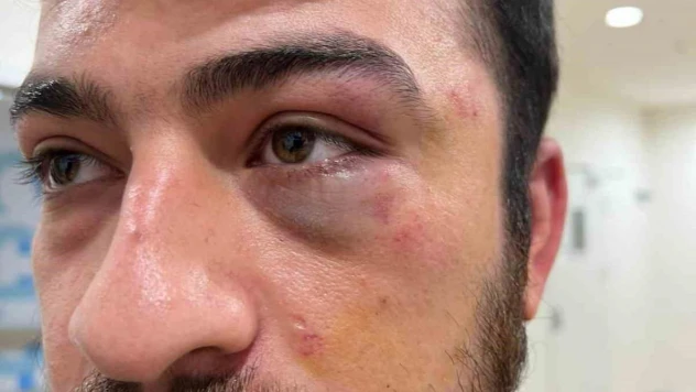 Şişli'de hemşir ile hasta arasında 'eldiveni değiştir' kavgası: 3 gözaltı