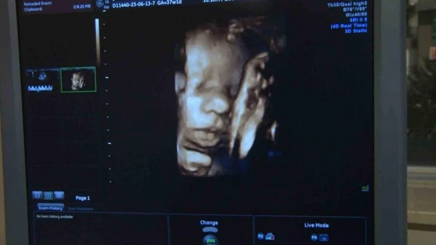 Türkiye'de 2021 yılında 32 bin olan HIV pozitif hasta sayısının, 2 kat fazla olduğu değerlendiriliyor