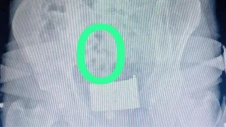 Erzurum'da 'yuttukları' eroinle yakalandılar!