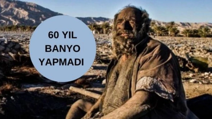 60 yıldır banyo yapmayan adam öldü