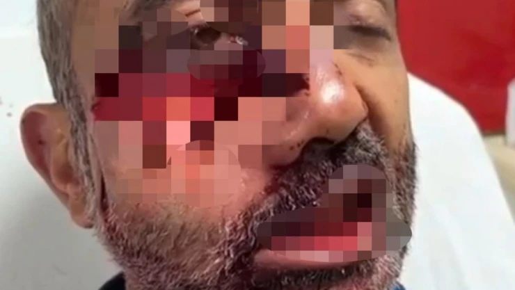 Hakkari'de tarlasına gitti iki ayının saldırısına uğradı