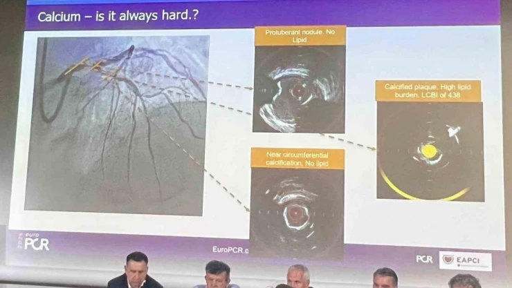 INVAMED Başkanı Dinç'ten, Paris'te 'yapay zeka destekli kardiyovasküler çözümlerde Türkiye lider' vurgusu