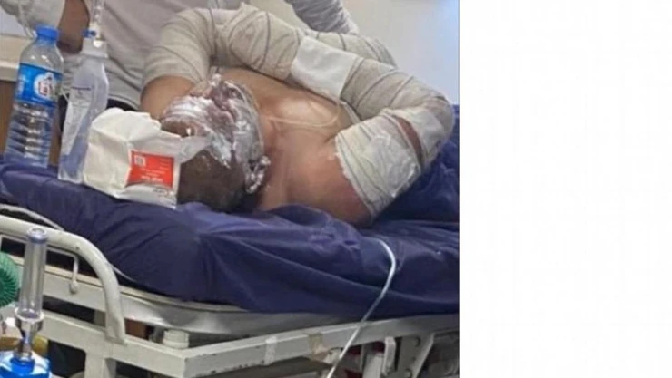 Şırnaklı şoför tırdaki patlamaya uykuda yakalandı