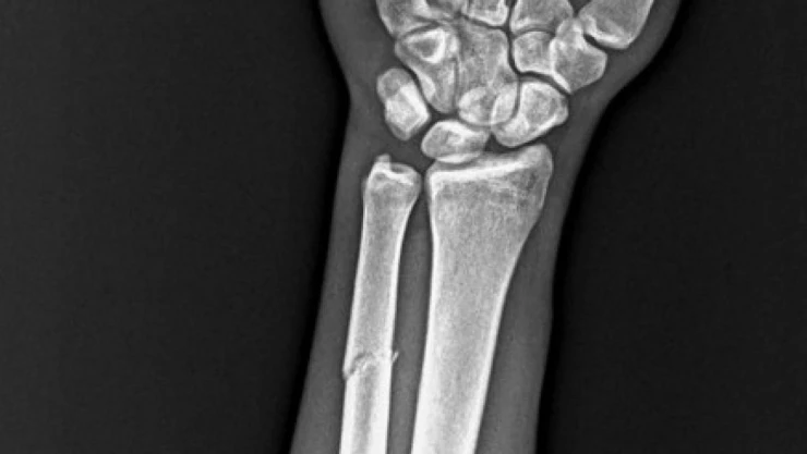 Trabzonspor'a Onuachu'dan kötü haber